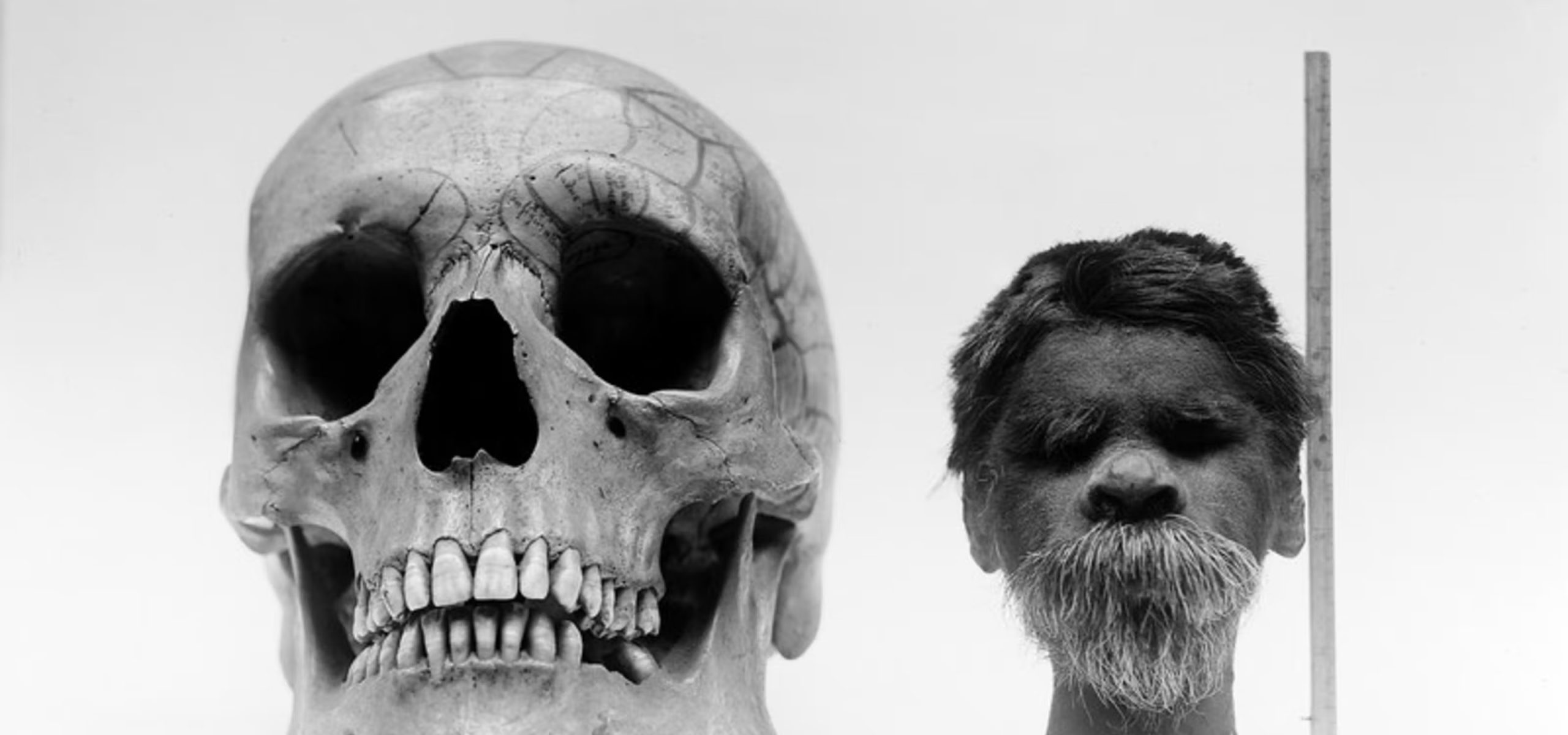 Shrunken head compared with normal skull